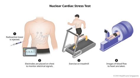 is nuclear stress test hard on kidneys|nuclear stress test heart disease.